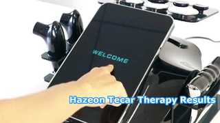 Μηχάνημα θεραπείας Hazeon Tecar RL-W20 – Προηγμένη συσκευή φυσιοθεραπείας και αποκατάστασης 448 kHz