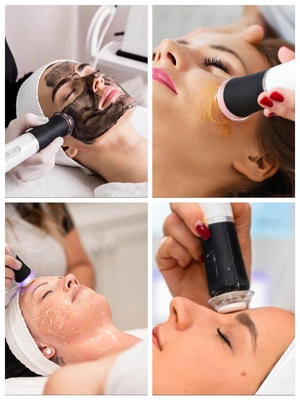 3 σε 1 Oxygen Jet Peel Infusion Face Lift Tightening Beauty Skin Care CO2 Φούσκα οξυγόνωσης Απολέπιση οξυγόνου Μηχανή προσώπου