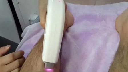 Ανταγωνιστική Τιμή Μηχανή Αποτρίχωσης Διοδικού Laser 808nm με Ενέργεια 1-50A και Πλάτος Παλμού 1-400ms για Χρήση σε Σαλόνι